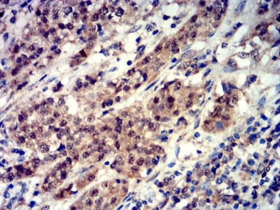 Monoclonal Mouse anti-Human EIF4EBP1 / 4EBP1 Antibody (clone 1E2E7, phospho-Ser65, IHC)