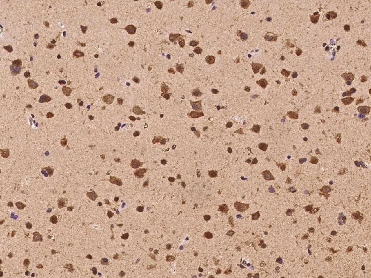 NACAD Antibody