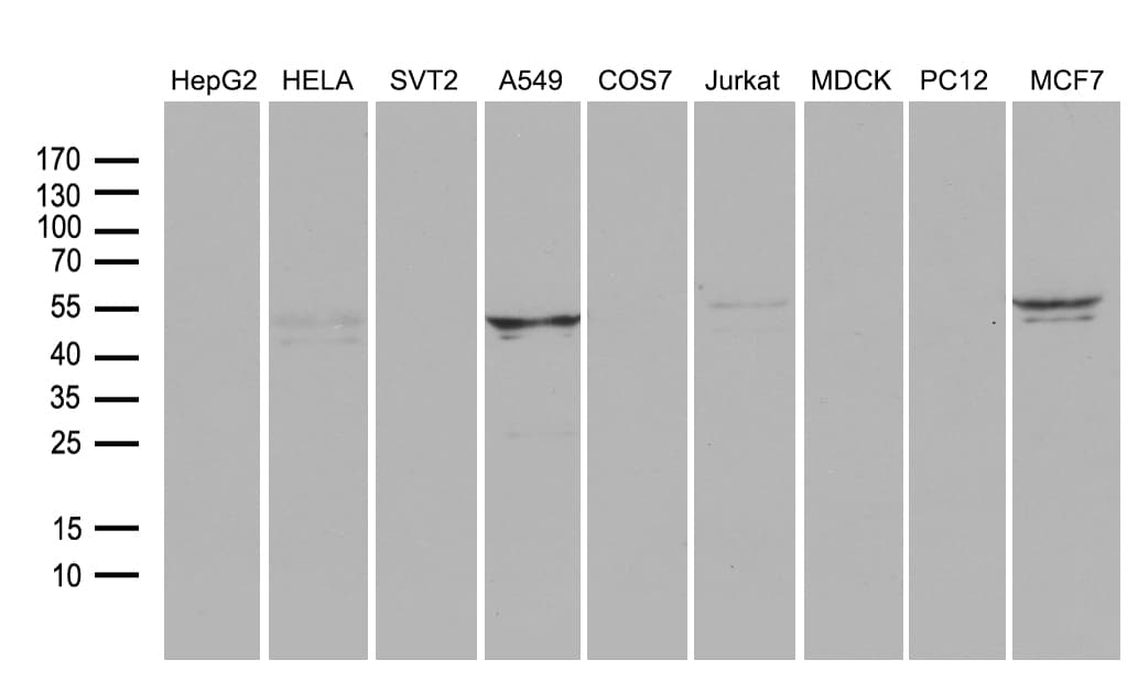 RNF149 Antibody (aa250-383, clone OTI9F11, Carrier-free)