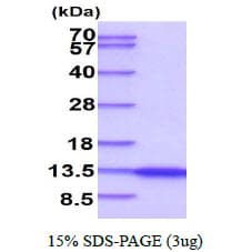 Human NEDD8 Protein (Recombinant His)