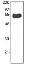 TREM1 Antibody (clone TREM-37)