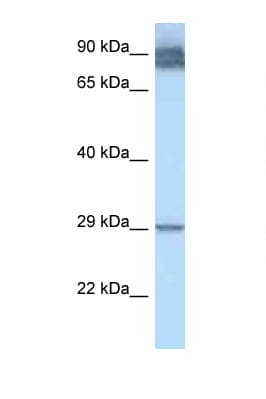 LRAT Antibody (aa51-100)