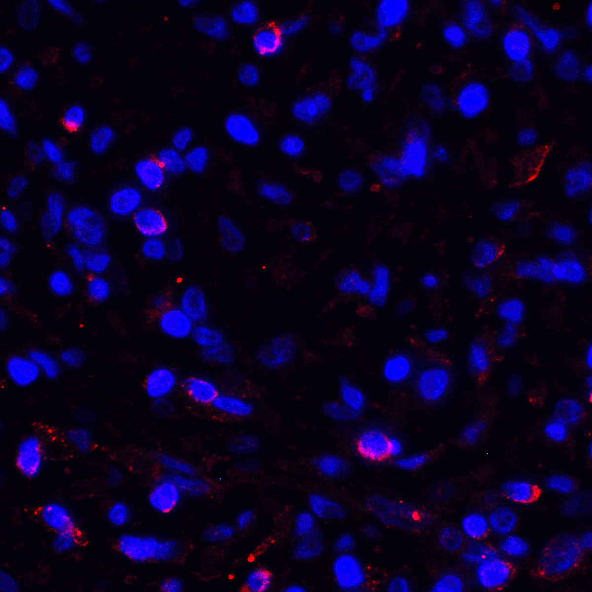 CD274 / B7-H1 / PD-L1 Antibody (clone 1F11)
