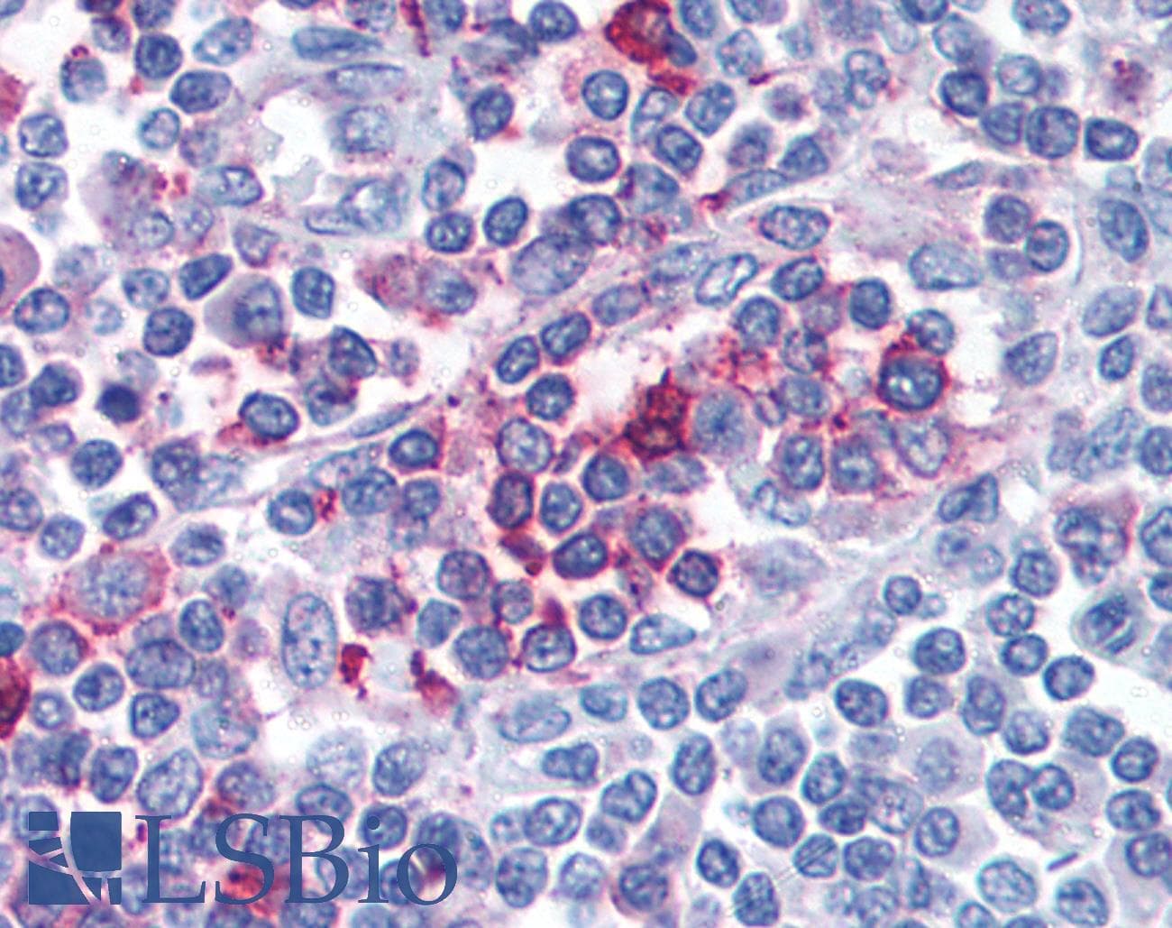 IHC-plus™ FPR1 / FPR Antibody (C-Terminus)