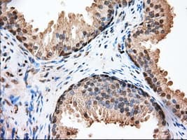 Monoclonal Mouse anti-Human GPI Antibody (clone OTI2D2, IHC, IF, WB)