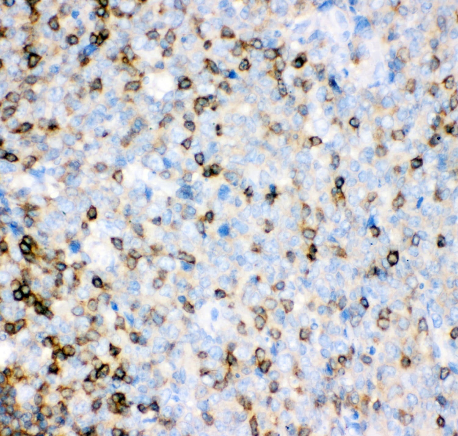 IL16 Antibody (aa1212-1332)