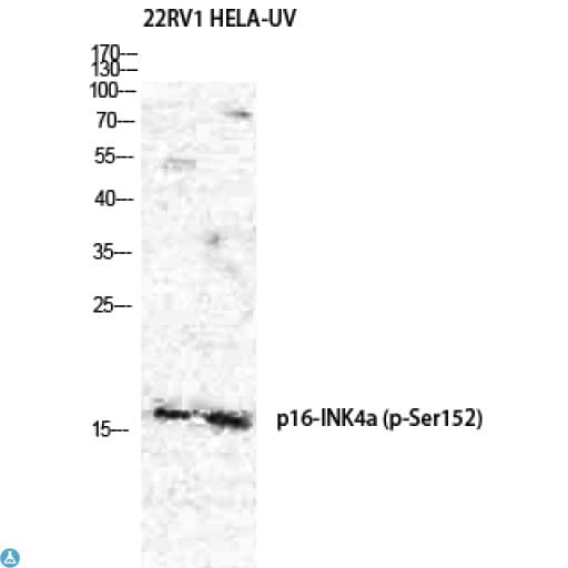 p16INK4a / CDKN2A Antibody