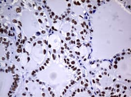 NBN / Nibrin Antibody (clone OTI2E10)