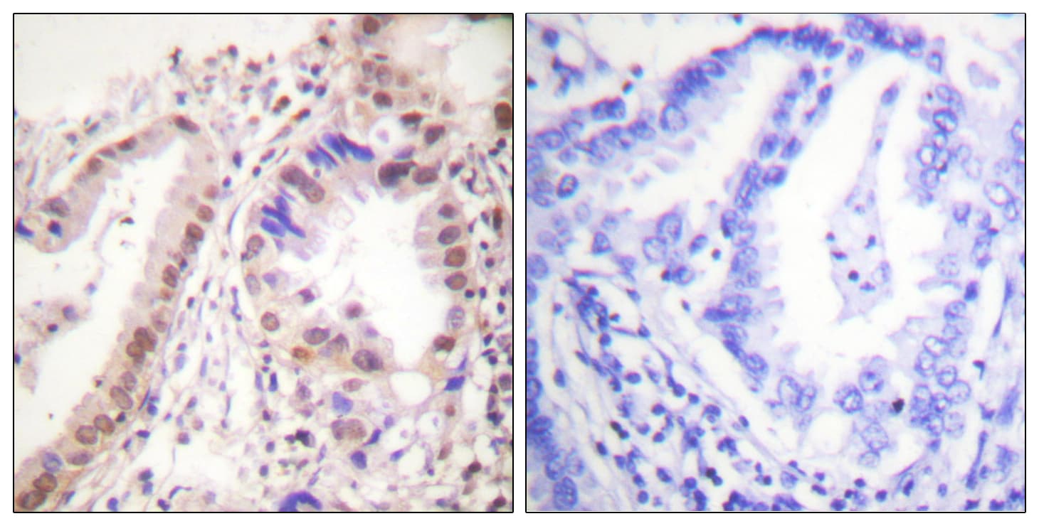 Polyclonal Rabbit anti-Human ER Alpha / Estrogen Receptor Antibody (aa501-550, IHC, IF, WB)