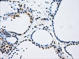 LOX / Lysyl Oxidase Antibody (clone OTI8G5)
