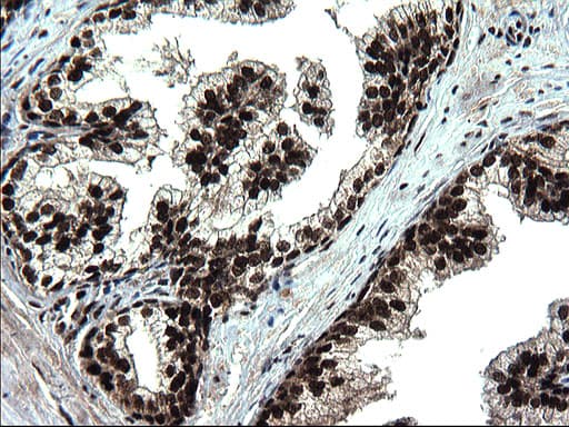RPRD1B Antibody (clone OTI1C9)