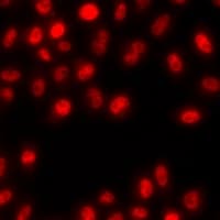 Polyclonal Rabbit anti-Human ZNF264 Antibody (IHC, IF, WB)