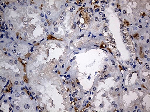 JUP/CTNNG/Junction Plakoglobin Antibody (aa500-745, clone OTI4D5)