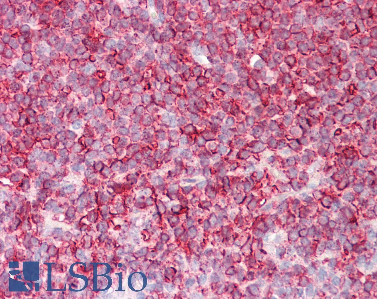 IHC-plus™ HLA-DR Antibody (clone LN3)