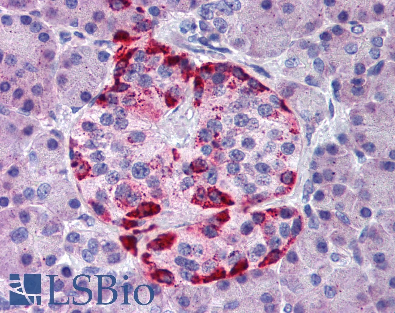 IHC-plus™ EPHA2 / EPH Receptor A2 Antibody (aa450-500)