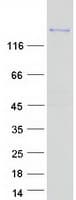 Human PNPLA6 / NTE Protein (Recombinant Myc-DDK (Flag))