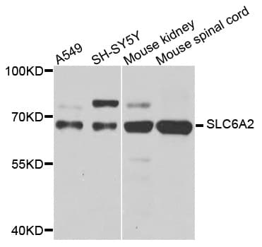 SLC6A2 / NET Antibody