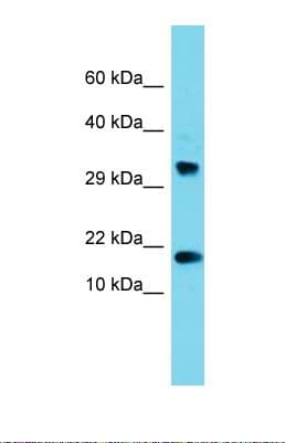 Polyclonal Rabbit anti-Human CPSF4L Antibody (N-Terminus, WB)