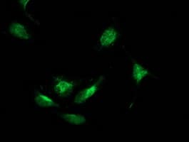 Monoclonal Mouse anti-Human BECN1 / Beclin-1 Antibody (clone OTI2C5, IF, WB)