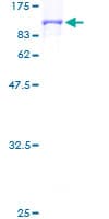 Human COG7 Protein (Recombinant GST)