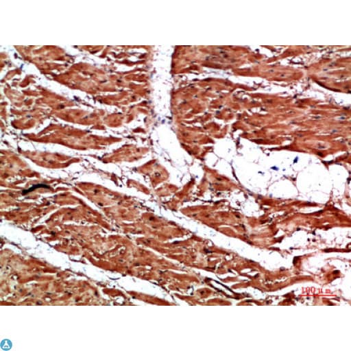 Polyclonal Rabbit anti-Human TTN / Titin Antibody (aa161-210, IHC)