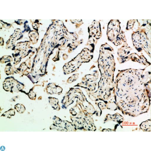Polyclonal Rabbit anti-Human TGFB2 / TGF Beta2 Antibody (IHC, WB)