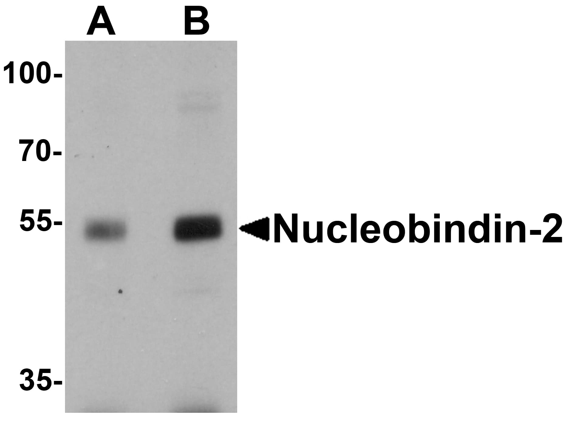 IHC-plus™ NUCB2 / Nucleobindin 2 Antibody