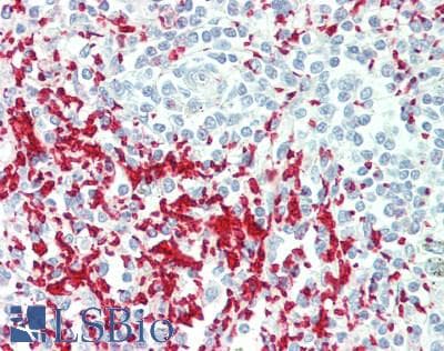 Polyclonal Rabbit anti-Human GP1BA / CD42b Antibody (aa19-291, IHC, WB)
