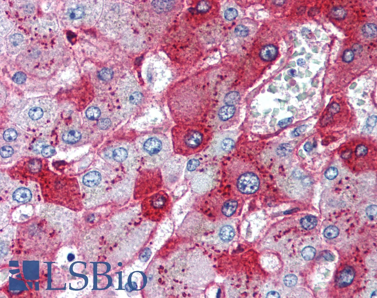 IHC-plus™ Monoclonal Mouse anti-Human VTN / Vitronectin Antibody (IHC, WB)