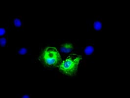 KRT8 / CK8 / Cytokeratin 8 Antibody (clone OTI2E4)