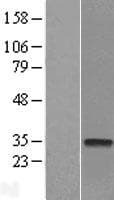 CTDSP2 Protein (Over-Expression Lysate Myc-DDK (Flag))