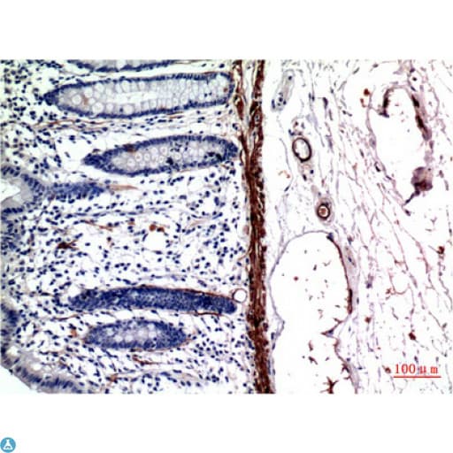 Muscle Actin Antibody