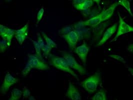 BUB1B / BubR1 Antibody (clone OTI3D9)