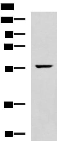 Polyclonal Rabbit anti-Human TRAF6 Antibody (IHC, WB)