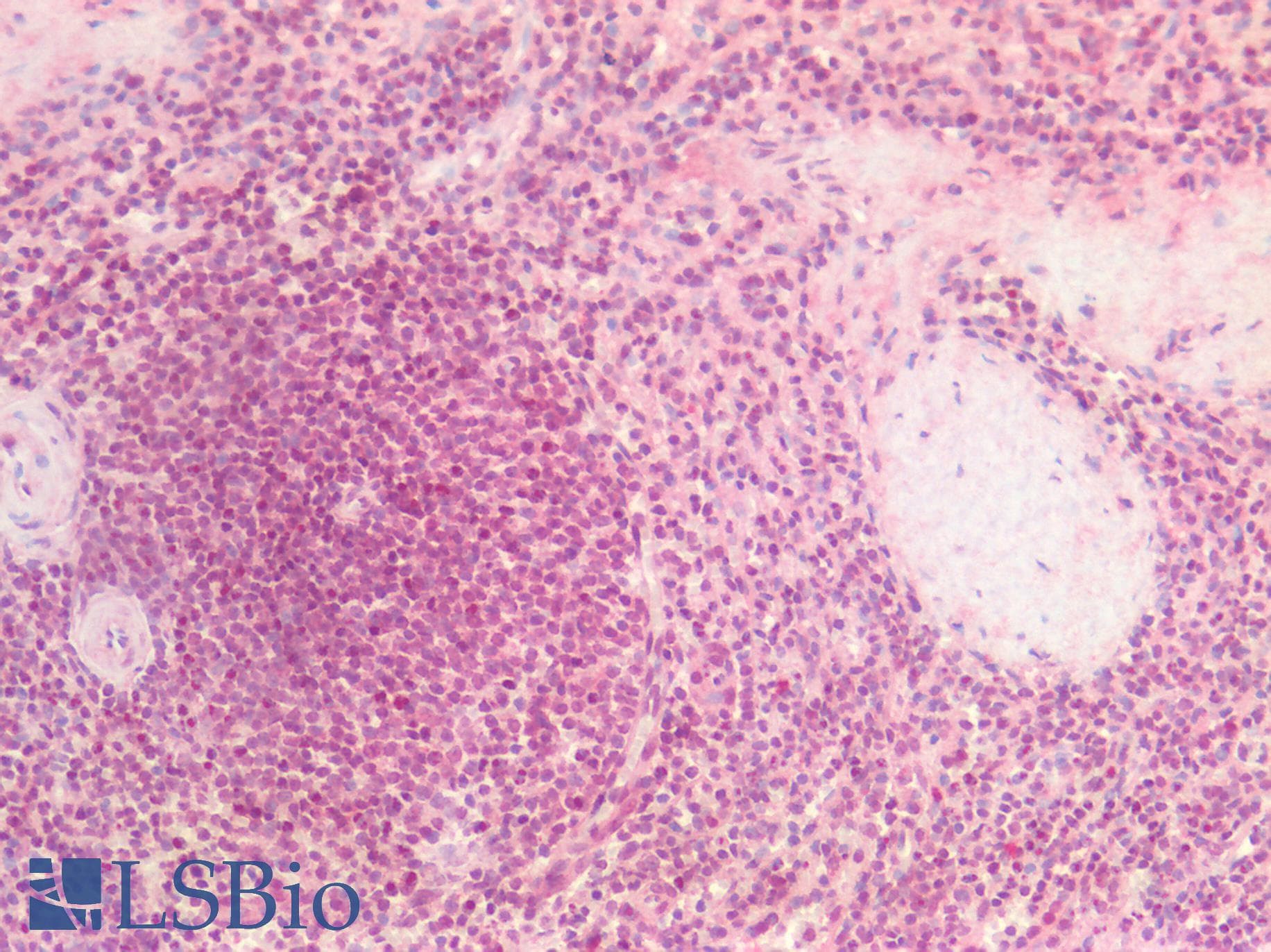 PathPlus™ CDKN1C / p57 Kip2 Antibody