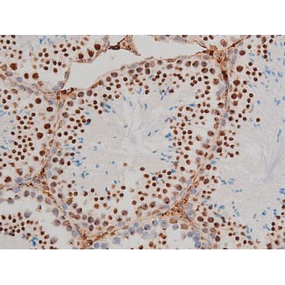 GATA1 Antibody (phospho-Ser142)