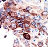 AXL Antibody (aa863-894)