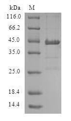 Human ACP1 / Acid Phosphatase Protein (Recombinant GST, N-terminus)