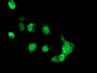 MAGEB18 Antibody (clone OTI1F5, Carrier-free)