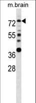 IHC-plus™ ER Alpha / Estrogen Receptor Antibody (aa53-301)