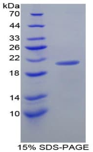 Mouse AOC1 Protein (Recombinant His)