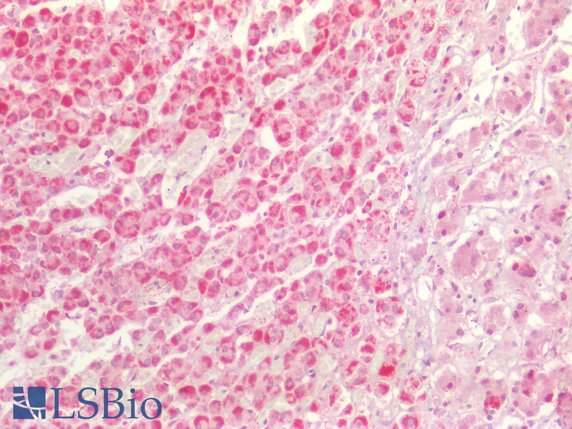 PathPlus™ SDHB Antibody (aa1-150)