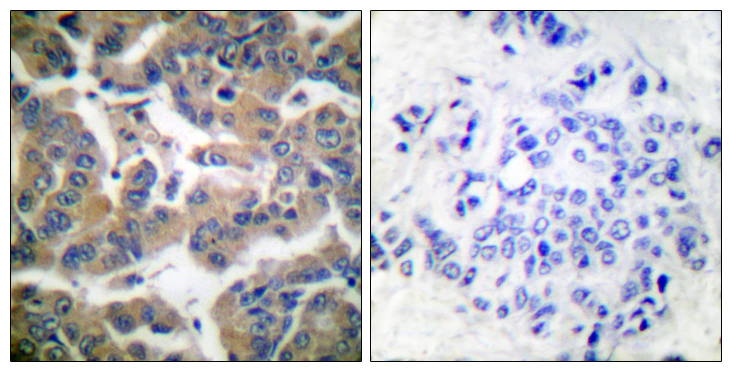 Polyclonal Rabbit anti-Human NR3C1/Glucocorticoid Receptor Antibody (phospho-Ser211, IHC, WB)