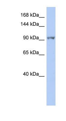 Polyclonal Rabbit anti-Human NEK9 Antibody (aa755-804, WB)