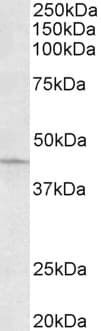 IHC-plus™ ARPC1A Antibody (aa356-368)