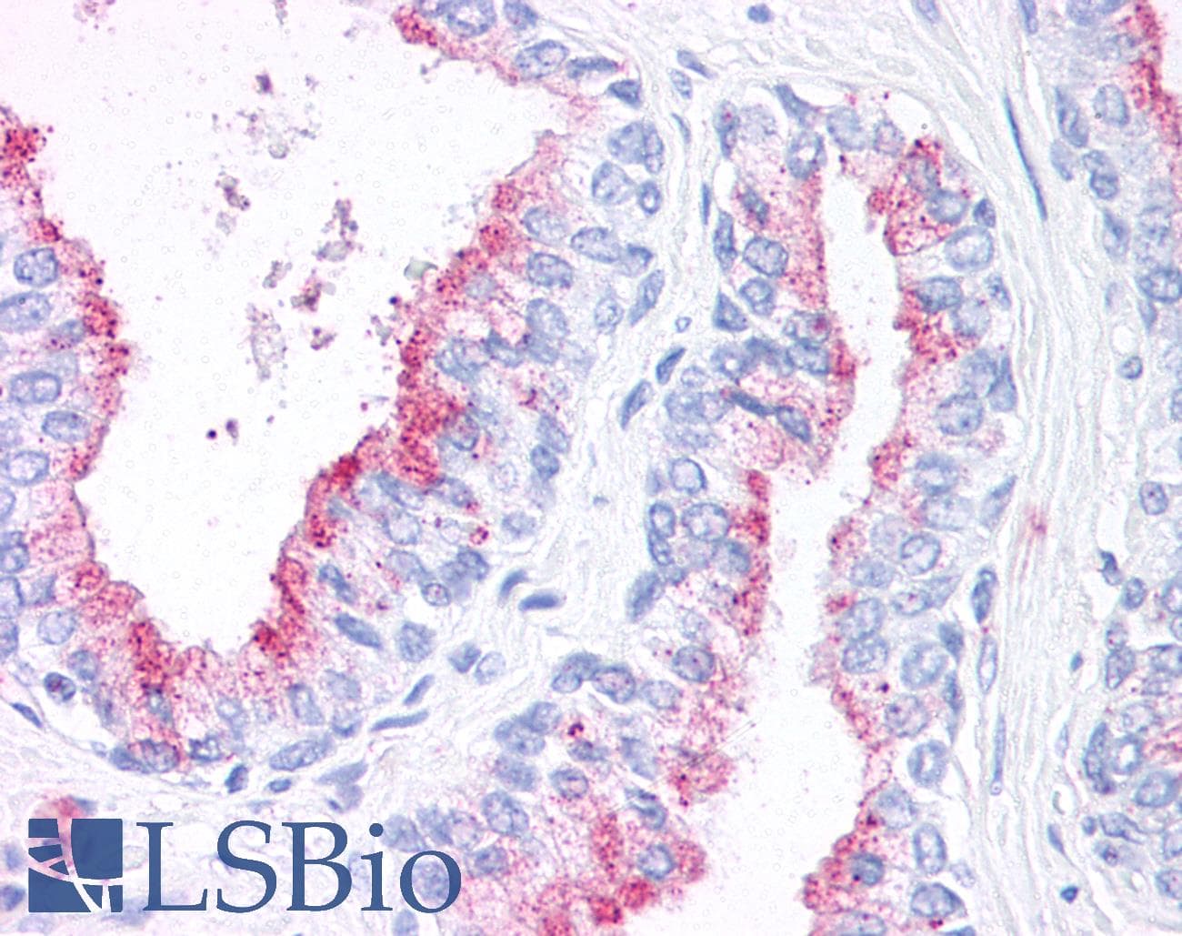 IHC-plus™ WNT5B Antibody (Internal)