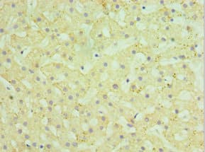 Polyclonal Rabbit anti-Human HYAL1 Antibody (aa136-435, IHC, WB)