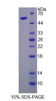 Human NFYC Protein (Recombinant His-GST)