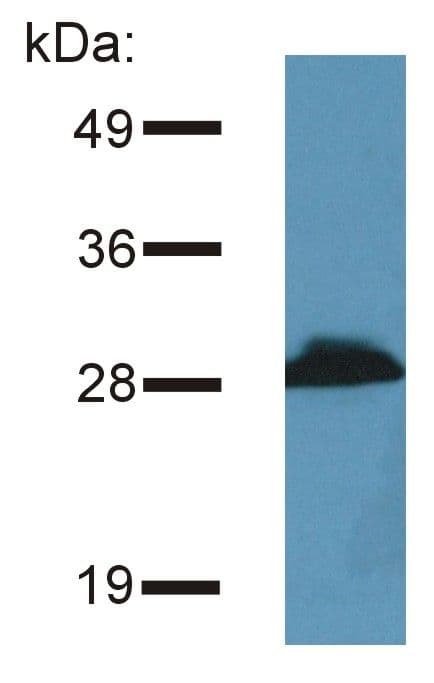 PRR7 Antibody (Amino Acid: 126-253, clone TRAP3/10)