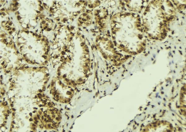 Polyclonal Rabbit anti-Human NOB1 / NOB1P Antibody (IHC, WB)